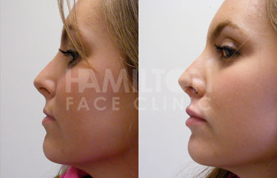 Photo of cosmetic treatment before and after